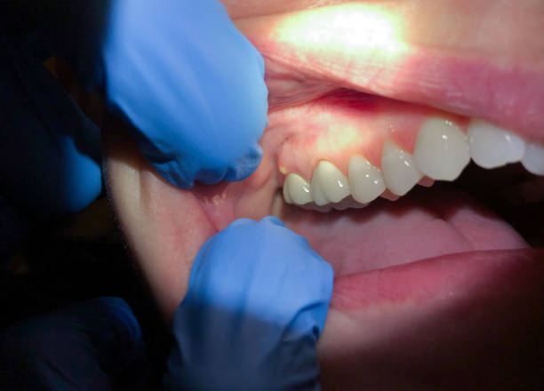 Best Emergency Cosmetic Dentistry in Rapid City, MI
