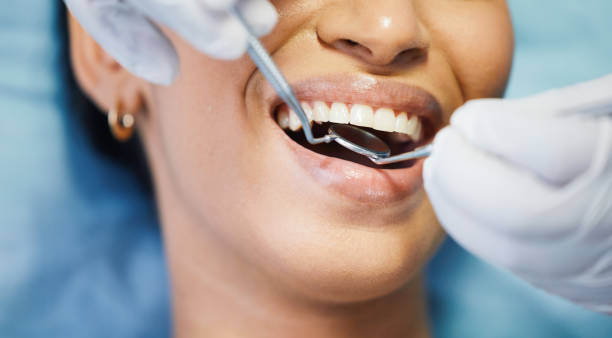 Best Emergency Dental Extractions in Rapid City, MI